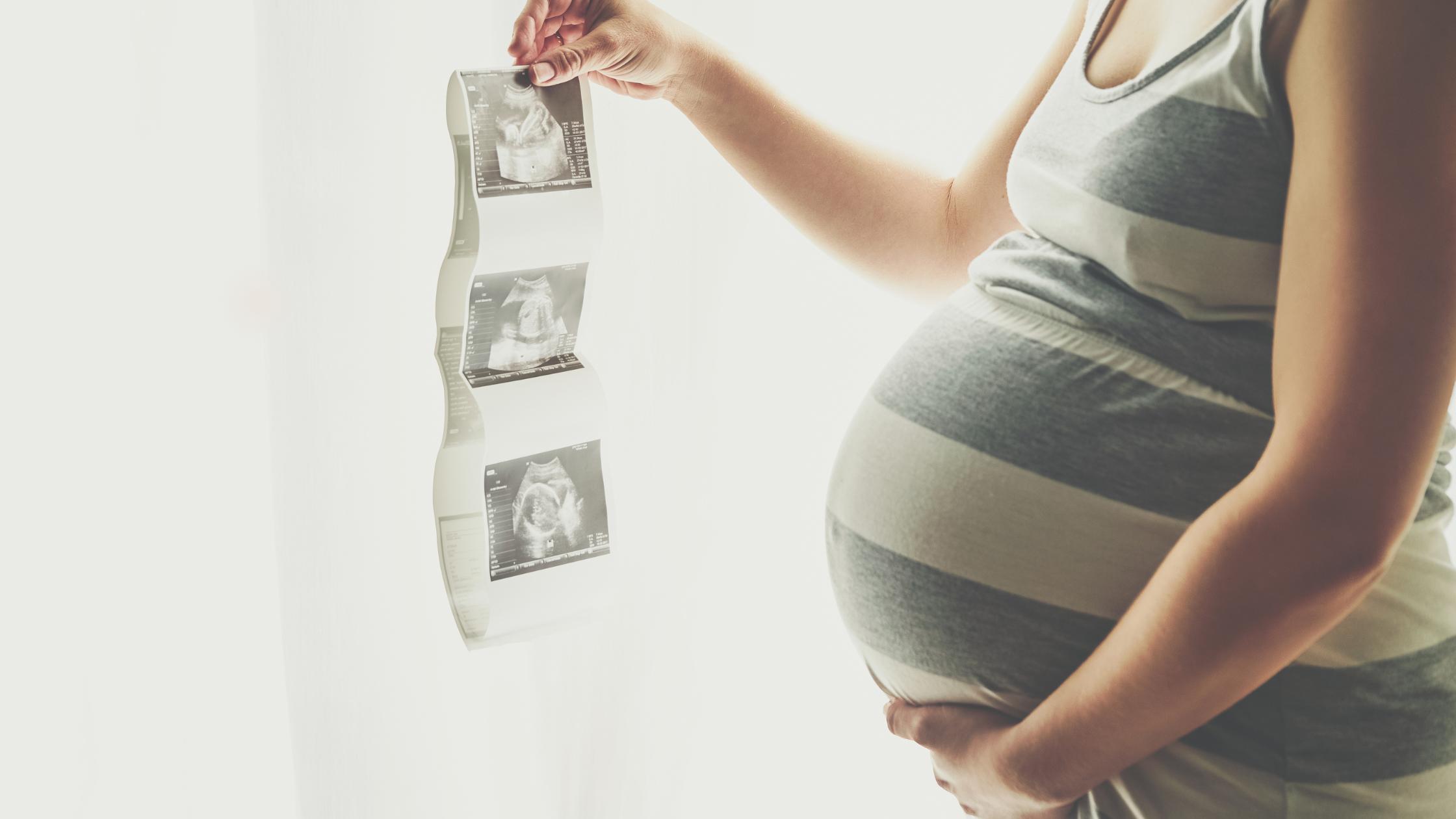 mulher grávida - Como auxiliar mulheres em trabalho de parto